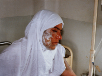 بانوی مجروح شیمیایی سردشت