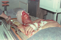 رادیولوژی اورژانس بیمارستان صحرایی