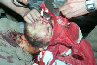 اتاق عمل بیمارستان شهری (9)