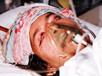 مجروح شیمیایی سردشت