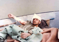 حمل مجروح با قایق