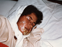 بانوی مجروح شیمیایی سردشت