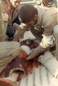 کنترل خونریزی توسط امدادگر