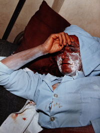 مجروحان شیمیایی سردشت