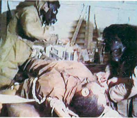 درمان اولیه مجروح شیمیایی